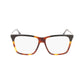 Victoria Beckham Black Acetate Glasses (Frames)
