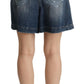 Dolce & Gabbana Chic High-Waisted Distressed Bermuda Shorts